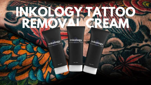 Inkology Tattoo Removal Creams